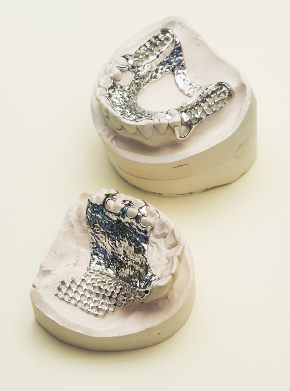 Výrobu zubních implantátů frézování nahradí 3D tisk. Foto: Renishaw
